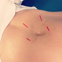 Logo for Anna Hajosi Acupuncture